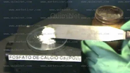 Imágen de fosfato calcio